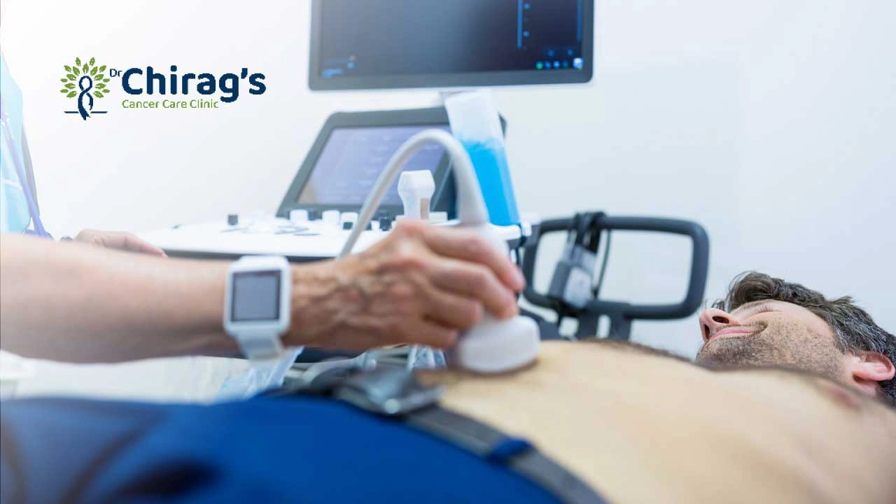 can-ultrasound-detect-bladder-cancer