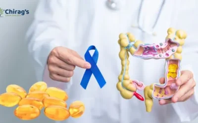 Can Vitamin D Help Prevent Colon Cancer?