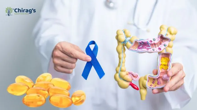 Prevent Colon Cancer Prevent Colon Cancer