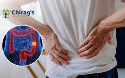 Can Colon Cancer Cause Back Pain?