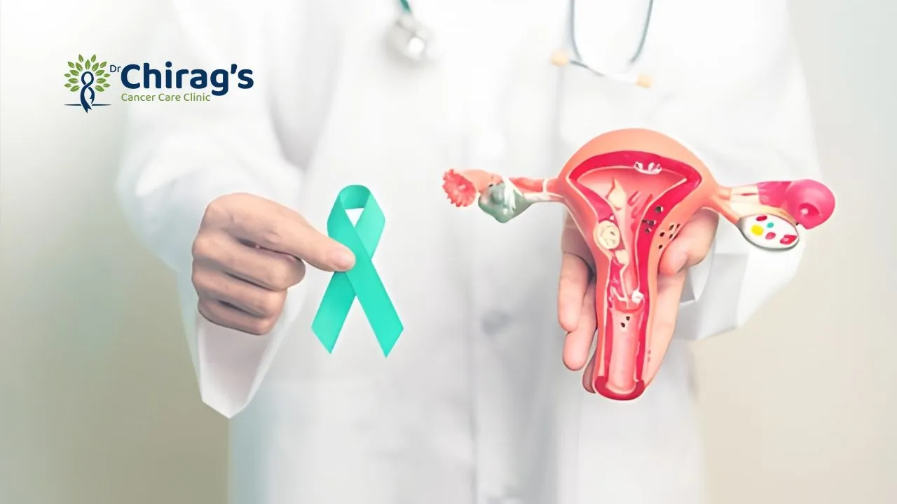 Endometrial Cancer Myths vs. Facts Endometrial Cancer Myths vs. Facts