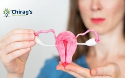 Is Endometrial Cancer The Same As Uterine Cancer?