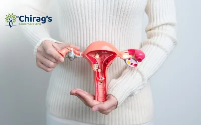 Does PCOS increases endometrial cancer risk?