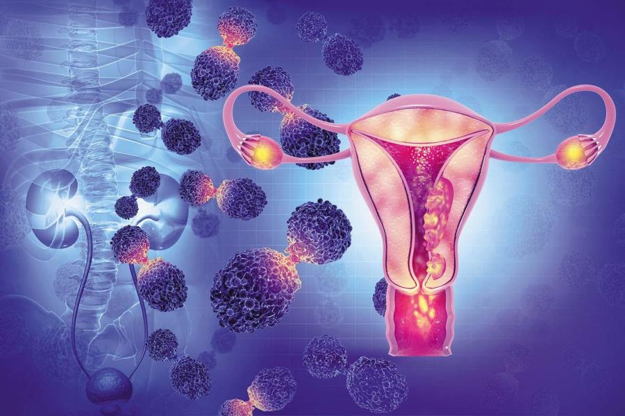 Gynecological cancer treatment in Pune by Dr. Chirag Bhirud showing advanced diagnosis and robotic surgery care