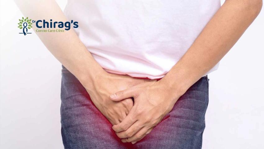 Dr. Chirag Bhirud explaining bladder cancer symptoms, stages, treatment options, and chances of cure for patients.