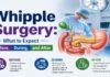 Whipple Surgery infographic showing what to expect before, during, and after pancreatic head surgery — Dr. Chirag Bhirud, Surgical Oncologist in Pune, Baner