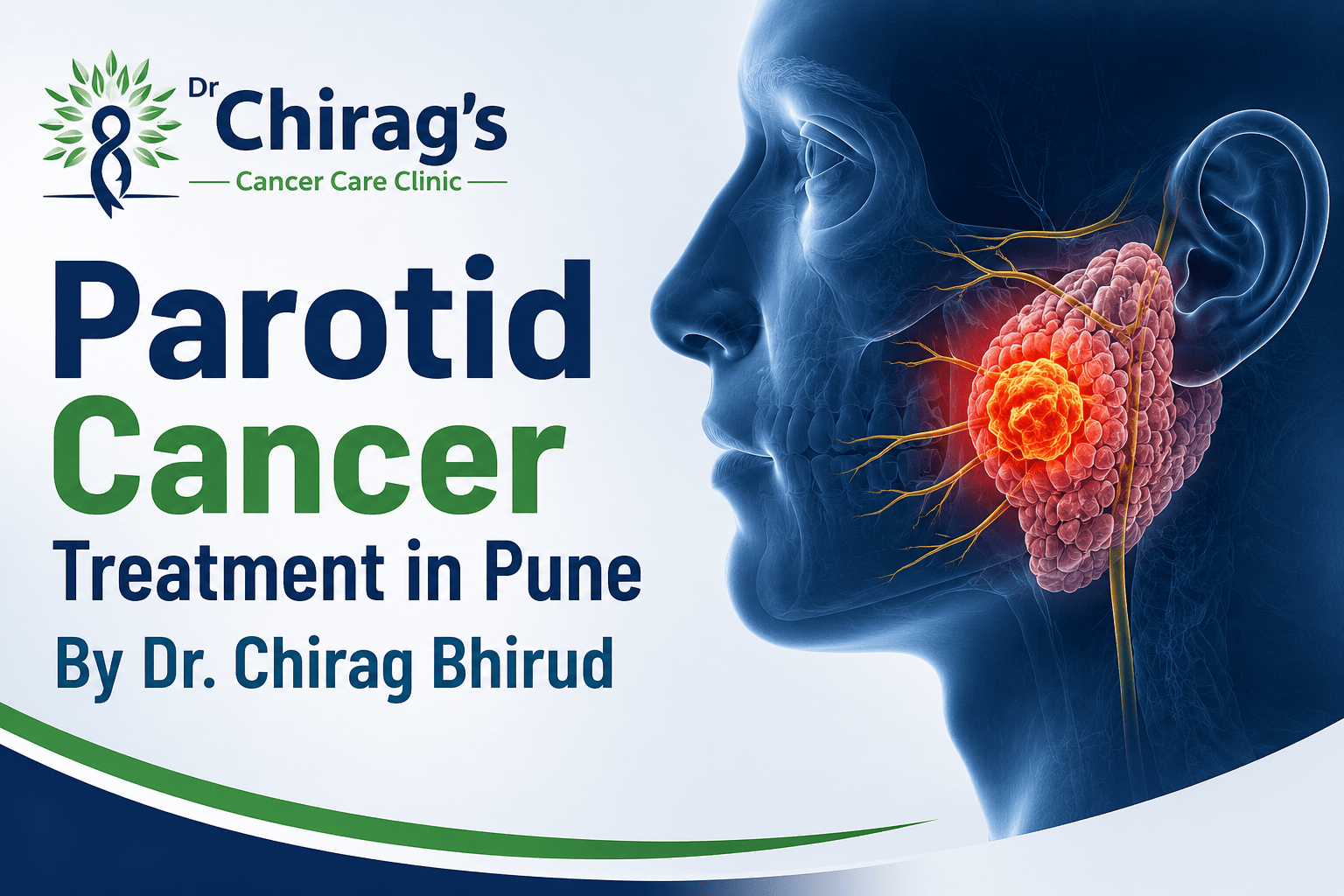 Parotid Cancer Treatment in Pune by Dr. Chirag Bhirud showing advanced diagnosis and surgical treatment for parotid gland cancer