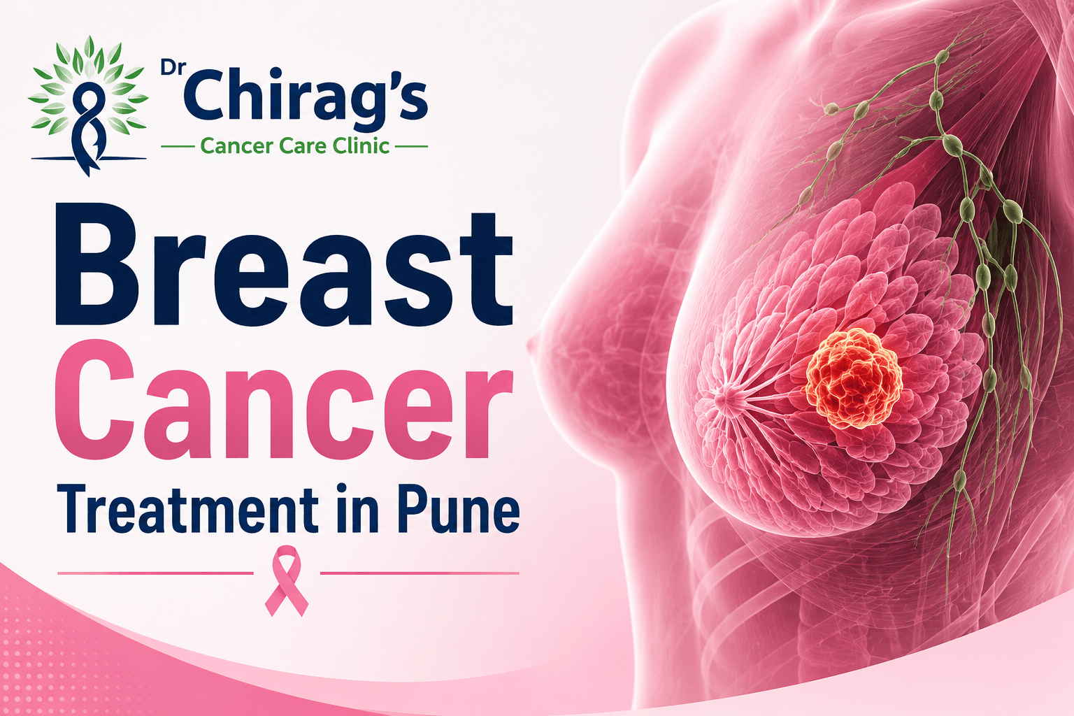 Breast Cancer Treatment in Pune by Dr. Chirag Bhirud showing breast anatomy with a highlighted cancer tumor, emphasizing advanced breast cancer diagnosis, surgery, and personalized cancer care.