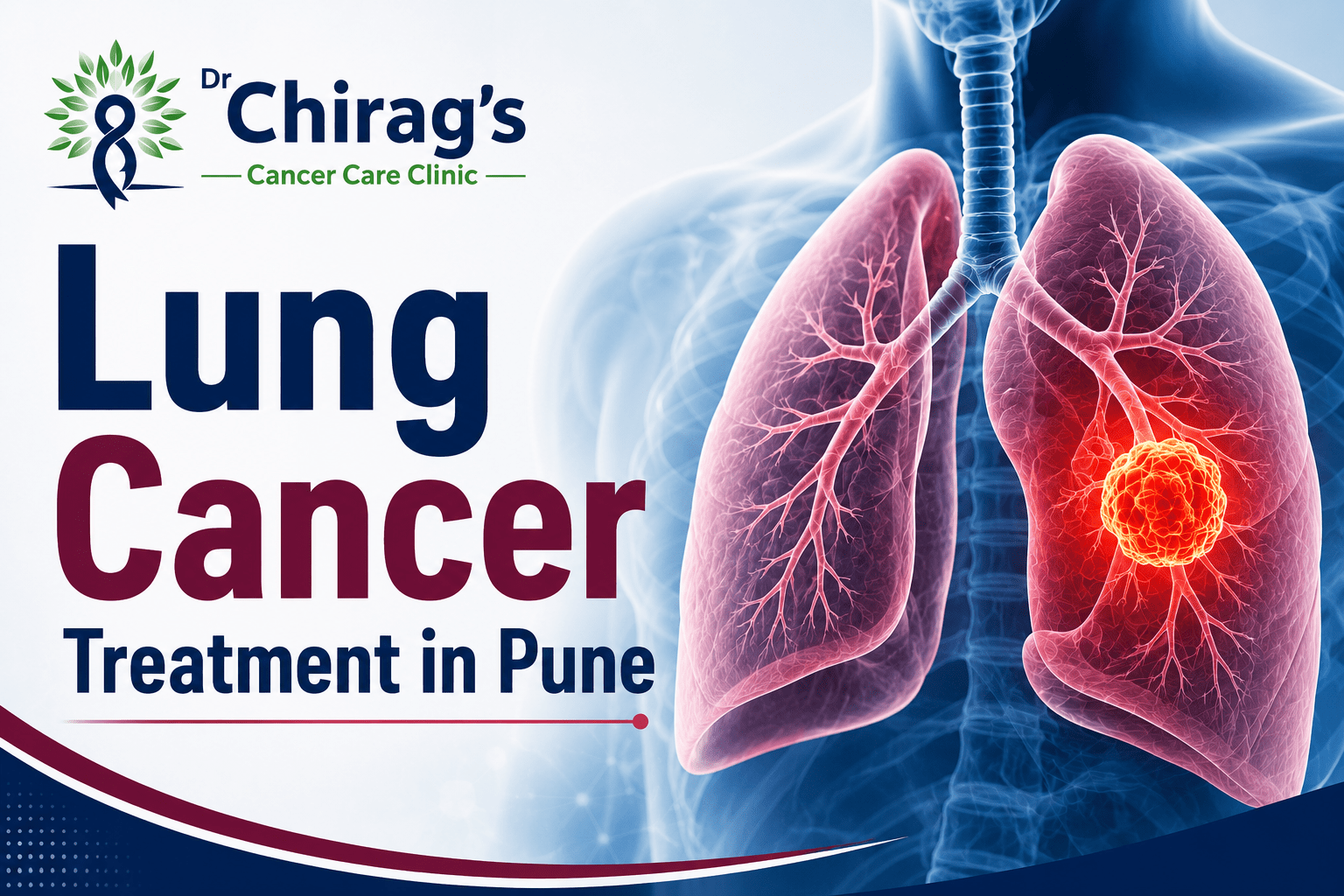 Lung Cancer Treatment in Pune by Dr. Chirag Bhirud with advanced diagnosis, robotic surgery, and personalised cancer care
