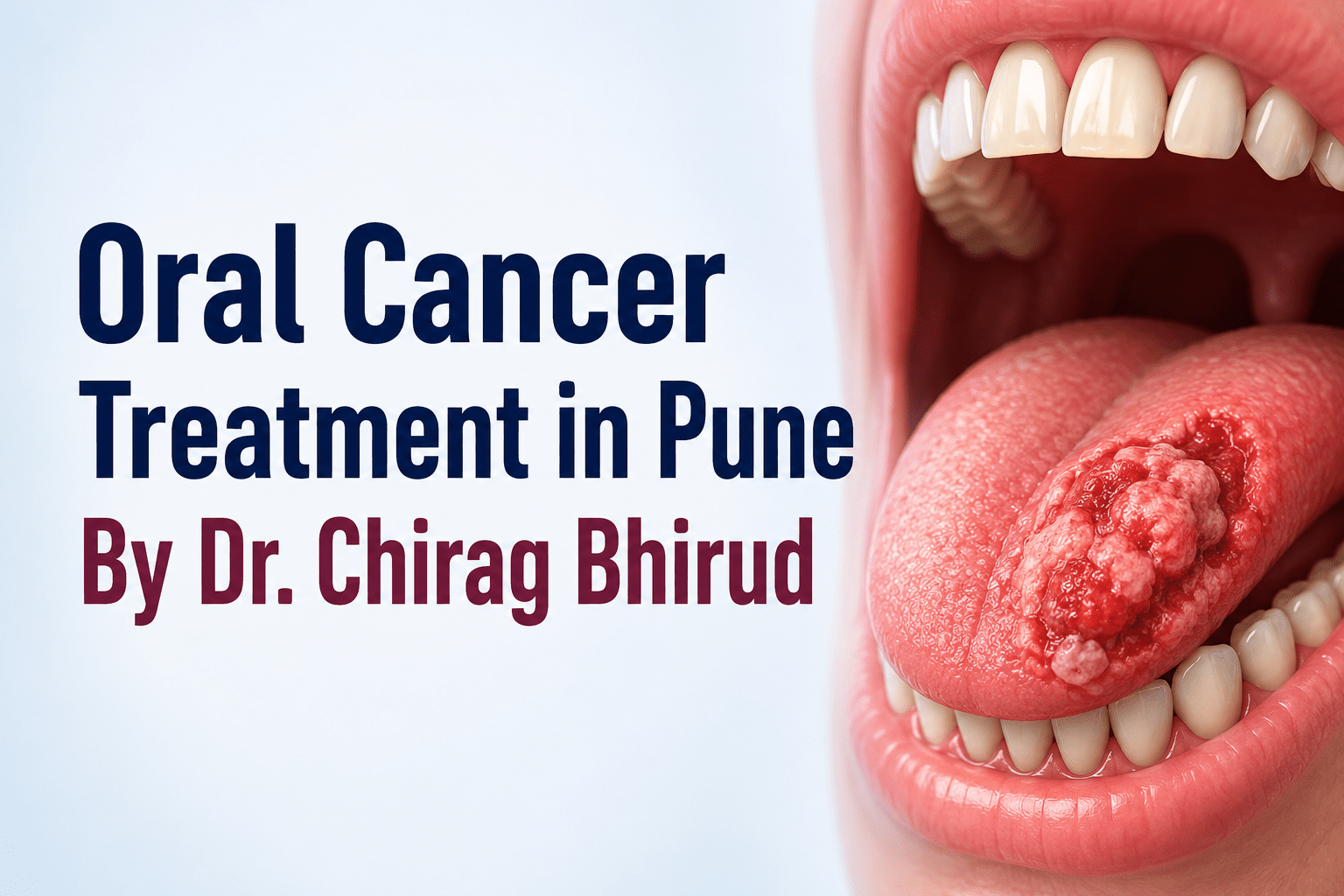 Oral Cancer Treatment in Pune | Dr. Chirag Bhirud