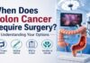 When Does Colon Cancer Require Surgery – surgical options infographic by Dr. Chirag Bhirud